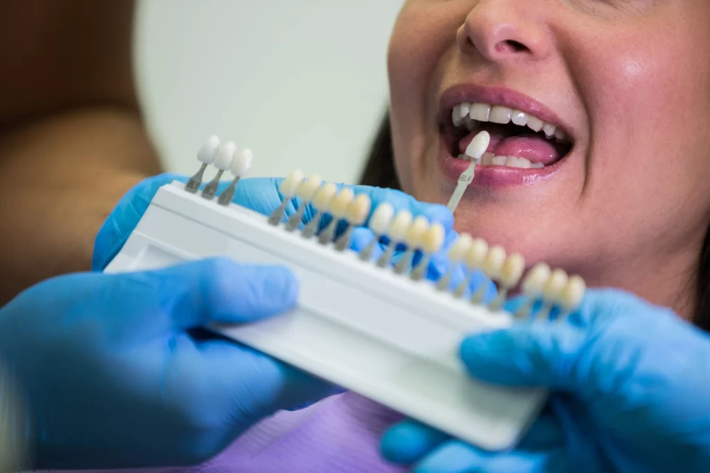 Tipos de implantes dentales y sus aplicaciones en odontología
