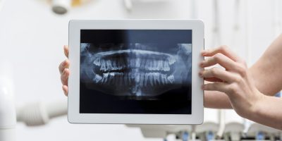 close-up-hands-holding-tablet-with-x-ray close-up-hands-holding-tablet-with-x-ray